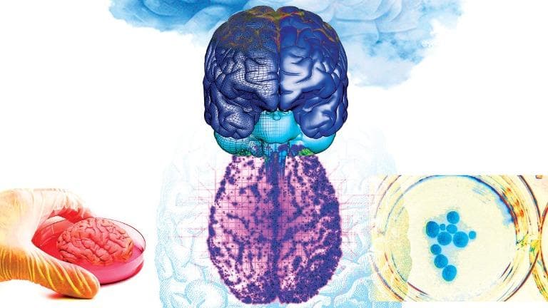 445 วิทย์คิดไม่ถึง สมองจำลองเปลี่ยนโลก