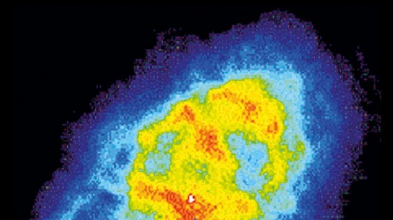 399 วิทย์คิดไม่ถึง กล้องโทรทรรศน์