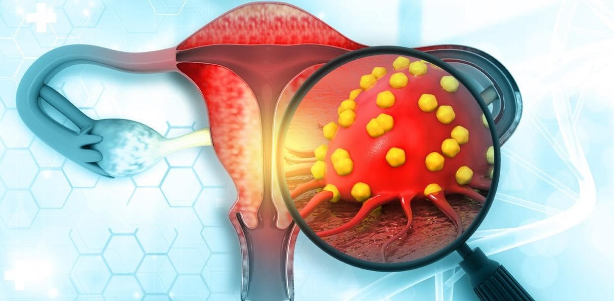 GSK’s Jemperli plus Zejula combination performs well in trial as endometrial cancer treatment