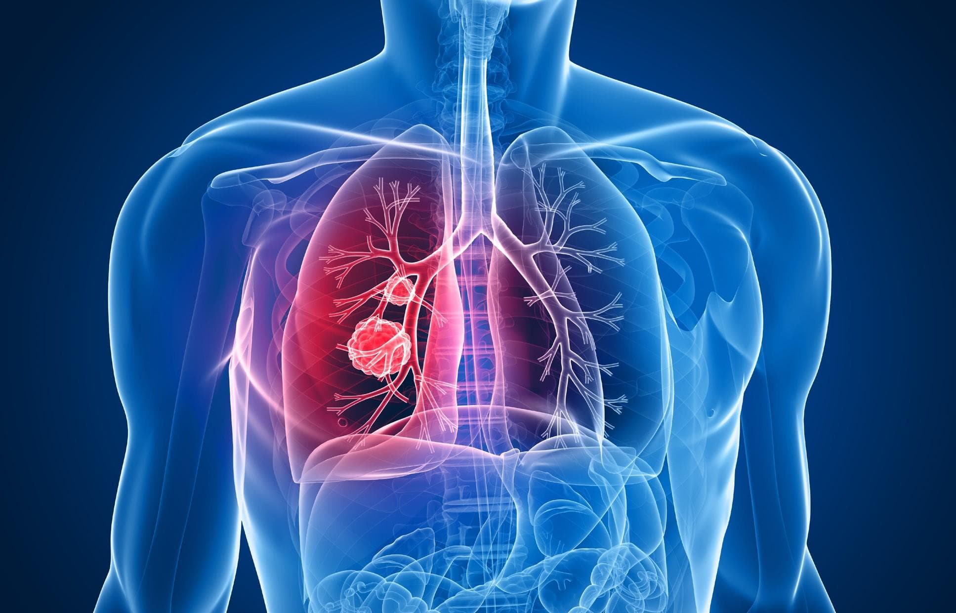 EMA accepts two applications for datopotamab deruxtecan for oncology treatments