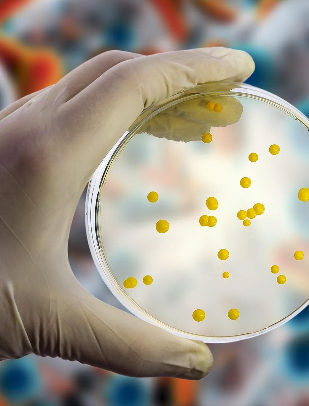 FDA grants IND clearance to Spero Therapeutics’ bacterial infection treatment