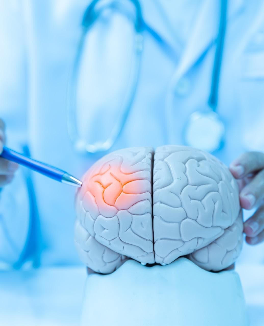 AbbVie’s migraine treatment recommended by NICE for NHS use