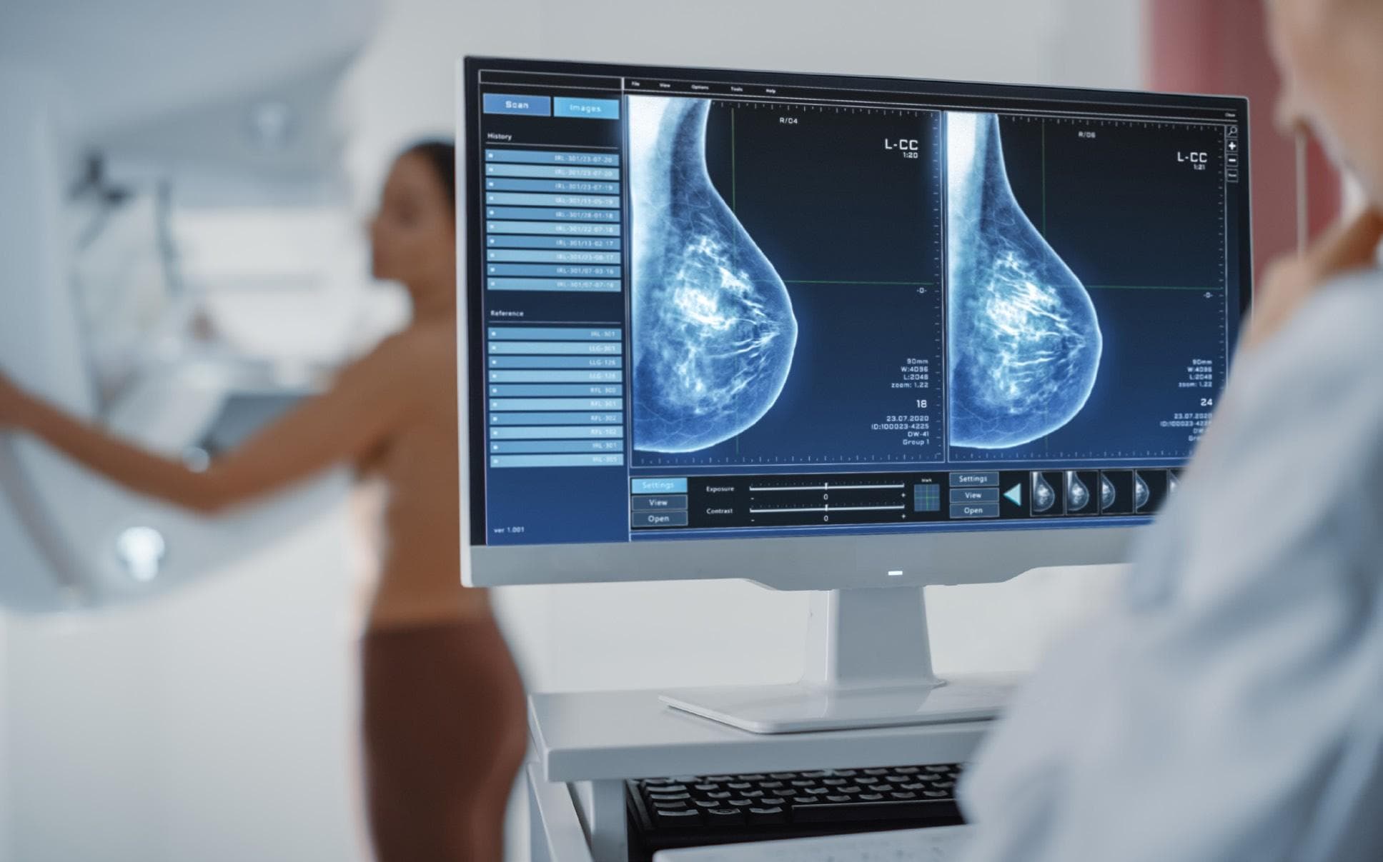AstraZeneca & Daiichi Sankyo’s BLA for datopotamab deruxtecan accepted by FDA for breast cancer