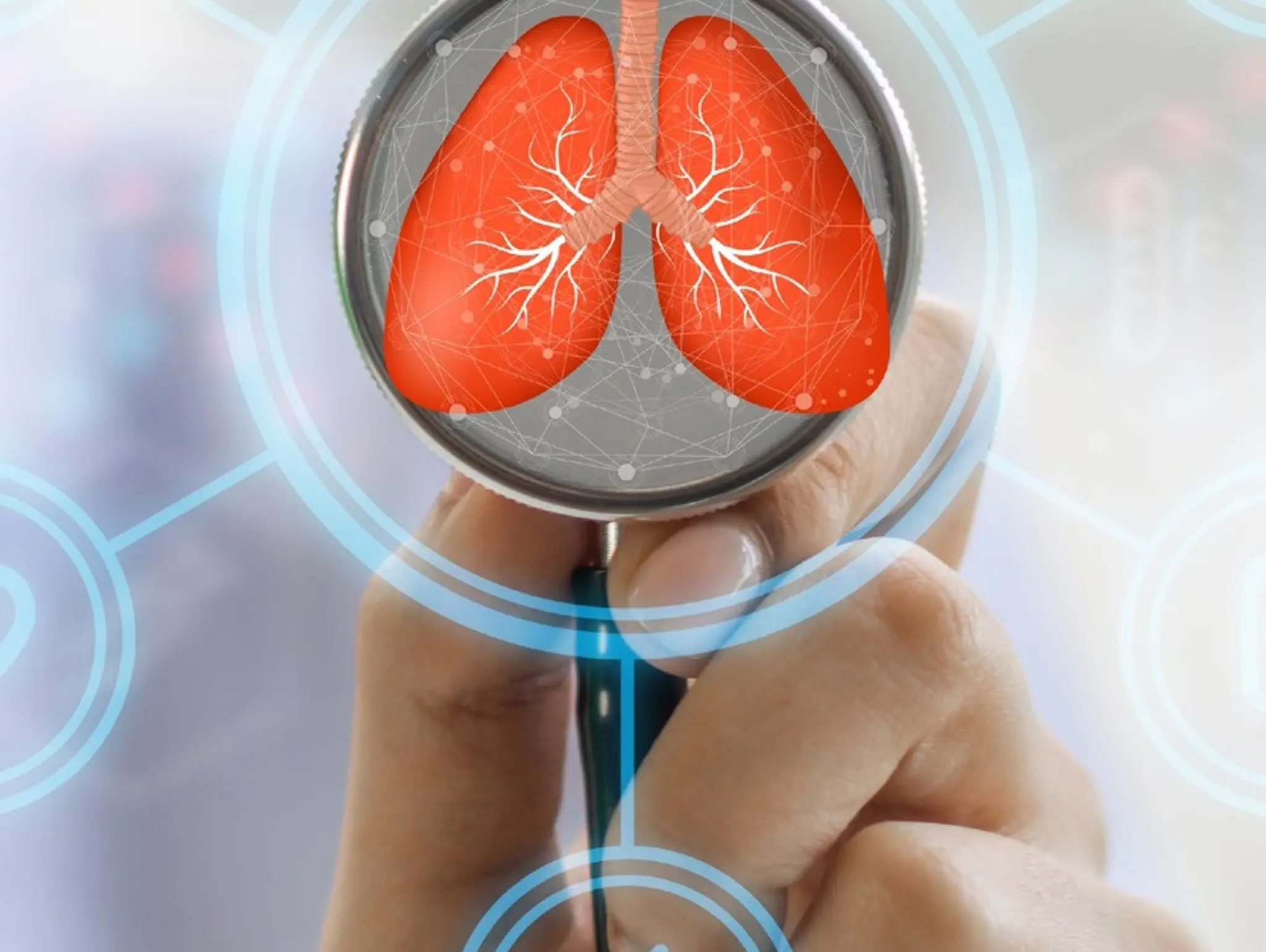 FDA approves Roche’s Alecensa lung cancer treatment