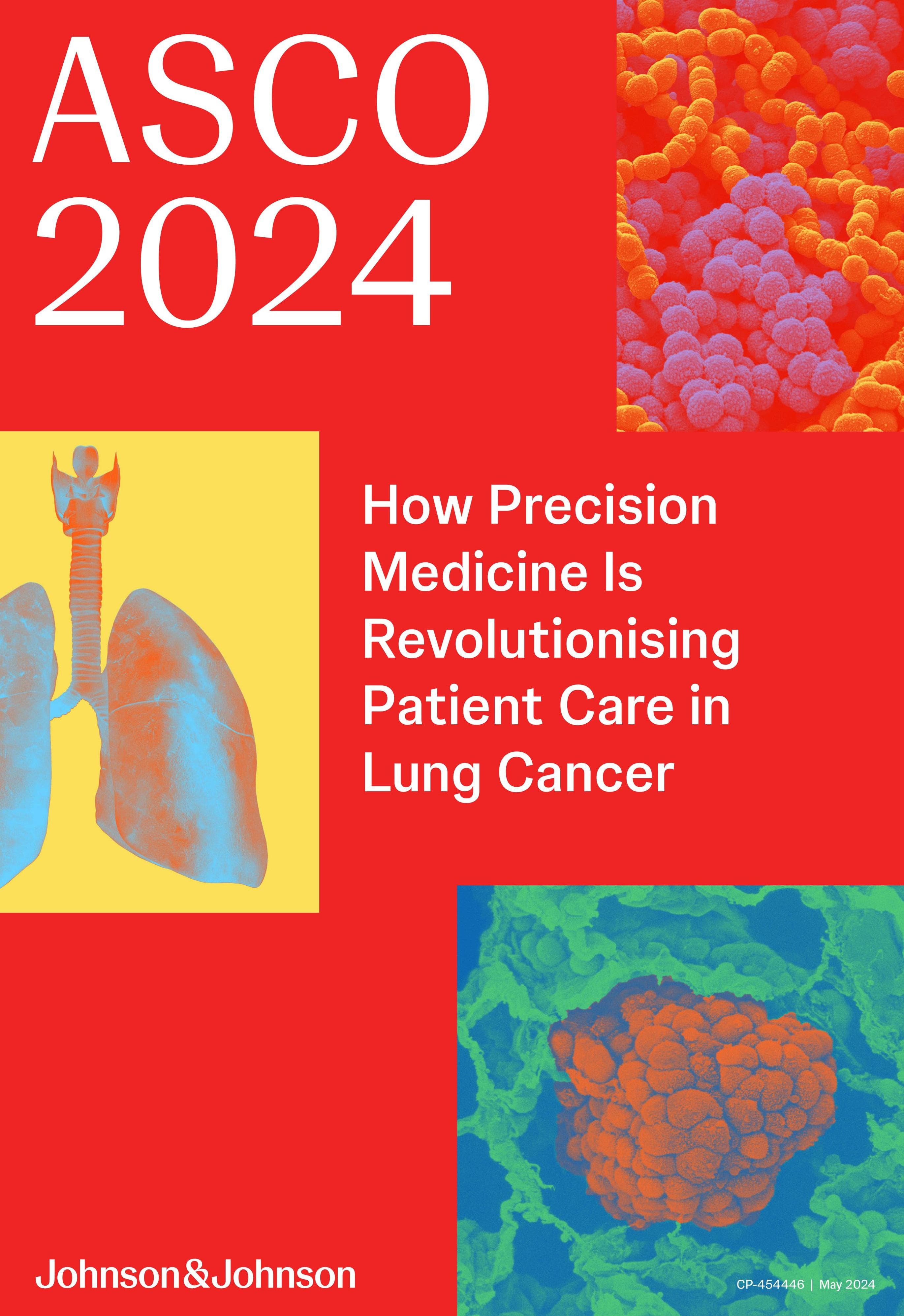 J&J ASCO 2024