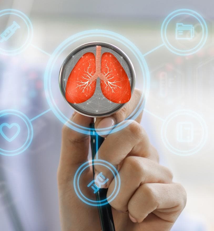 Amgen’s Imdelltra approved by FDA for extensive-stage small cell lung cancer