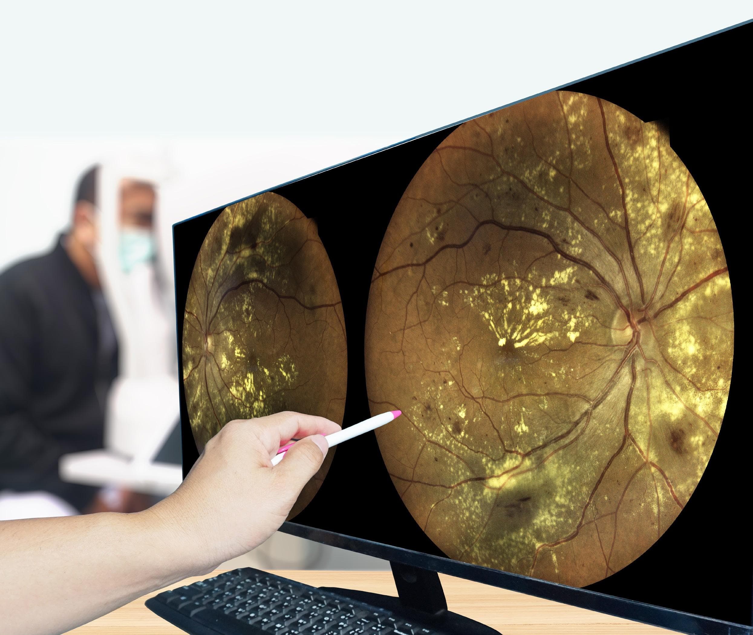 Managing Patients with Diabetes