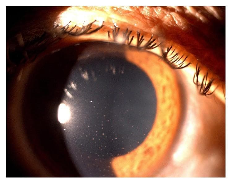 Ocular Therapeutics in Clinical Practice: The Times, They Are A-Changing