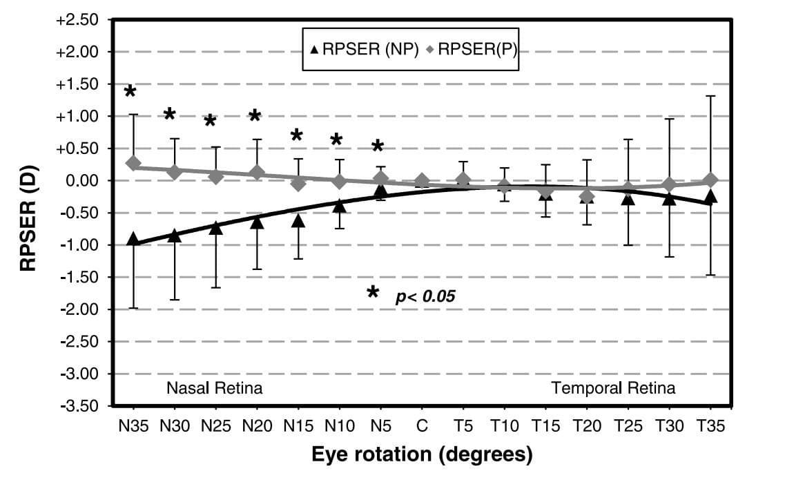 MyoMe and MyoStock: Innovation in Myopia Management