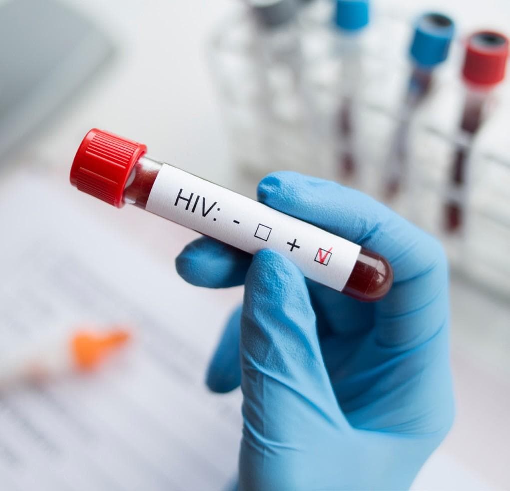 Gilead announces data from phase 3 HIV prevention trial