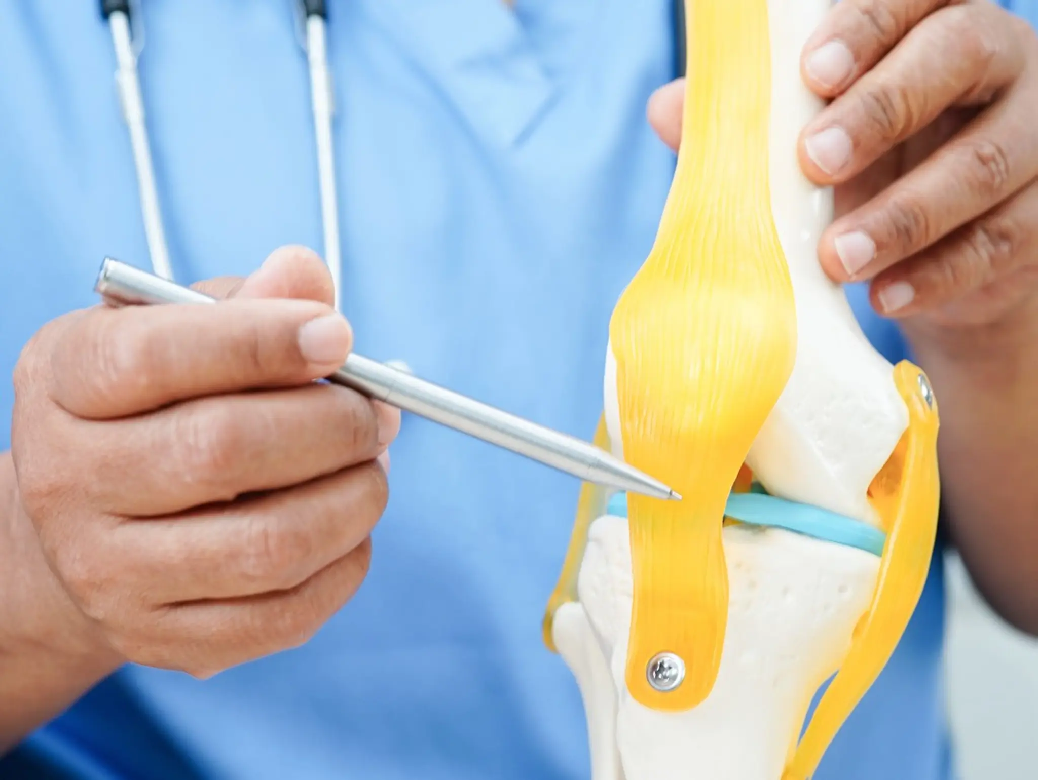 Positive results announced for Levicept’s moderate-to-severe osteoarthritis treatment