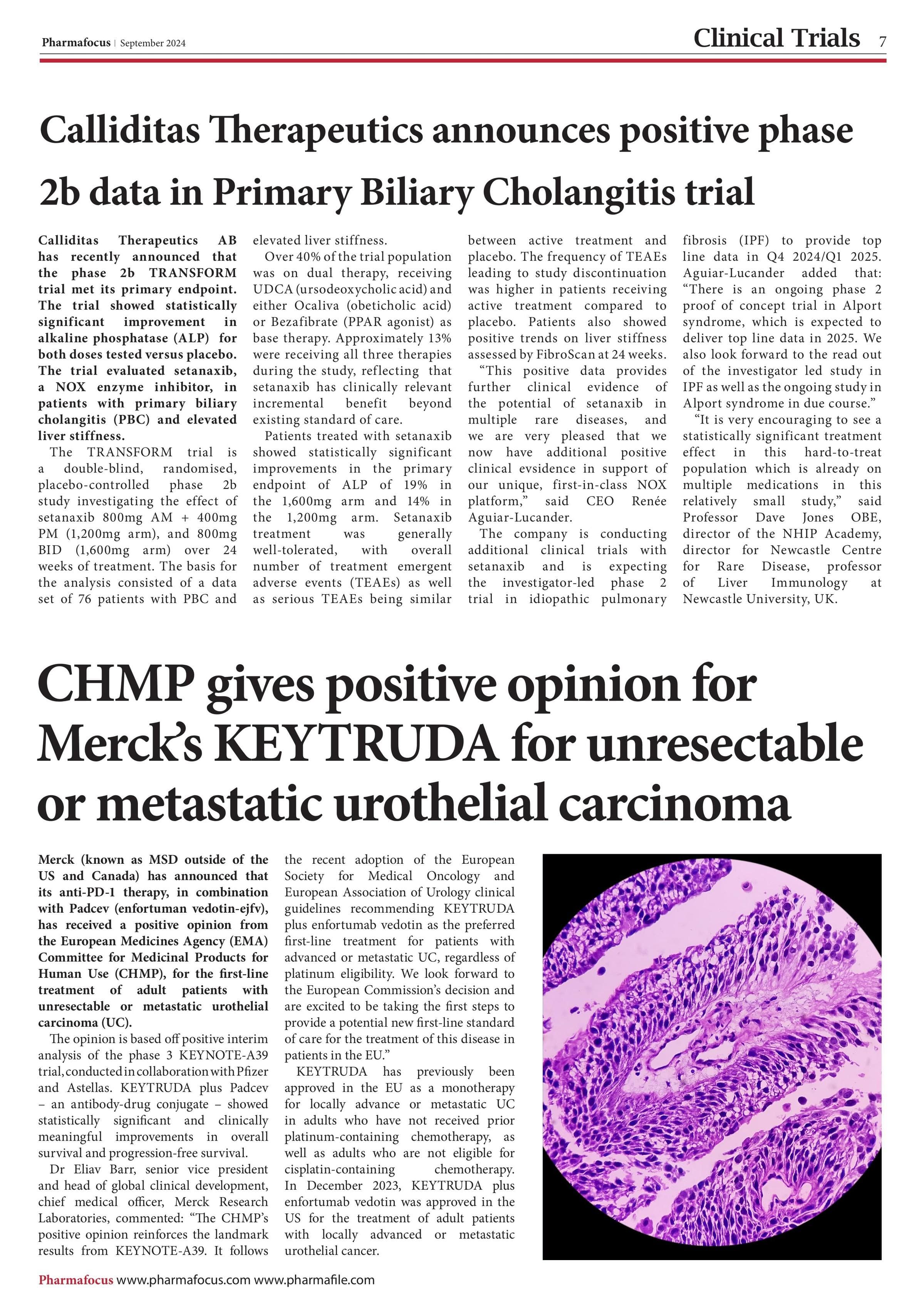 Calliditas Therapeutics announces positive phase 2b data in Primary Biliary Cholangitis trial