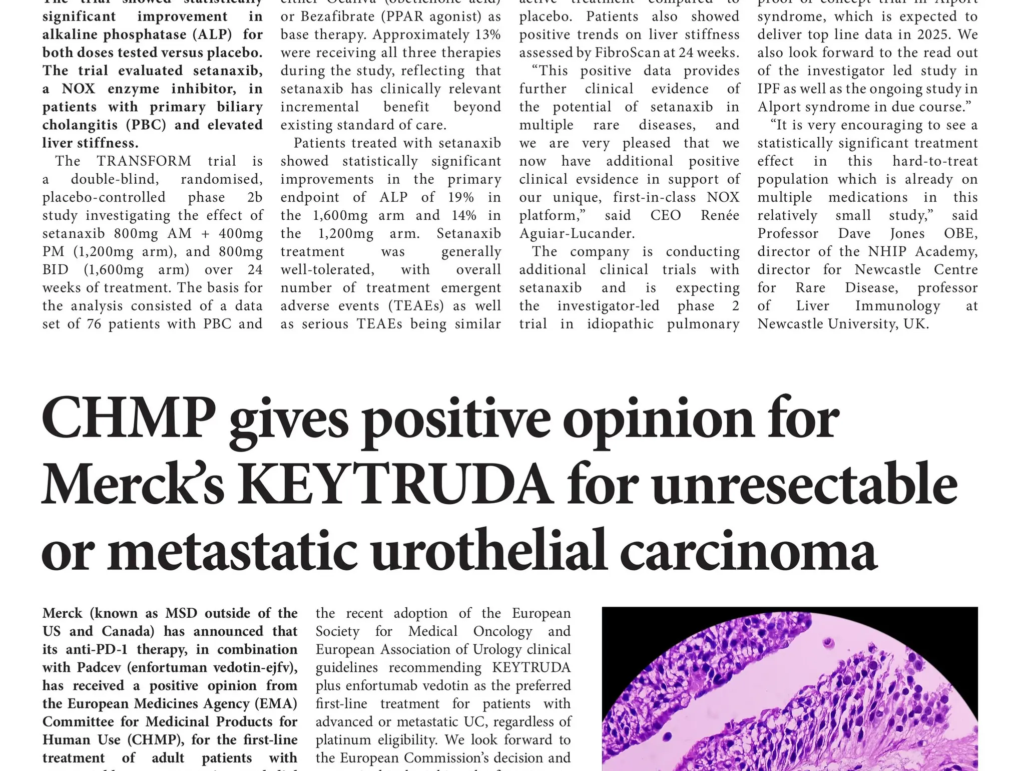 Calliditas Therapeutics announces positive phase 2b data in Primary Biliary Cholangitis trial