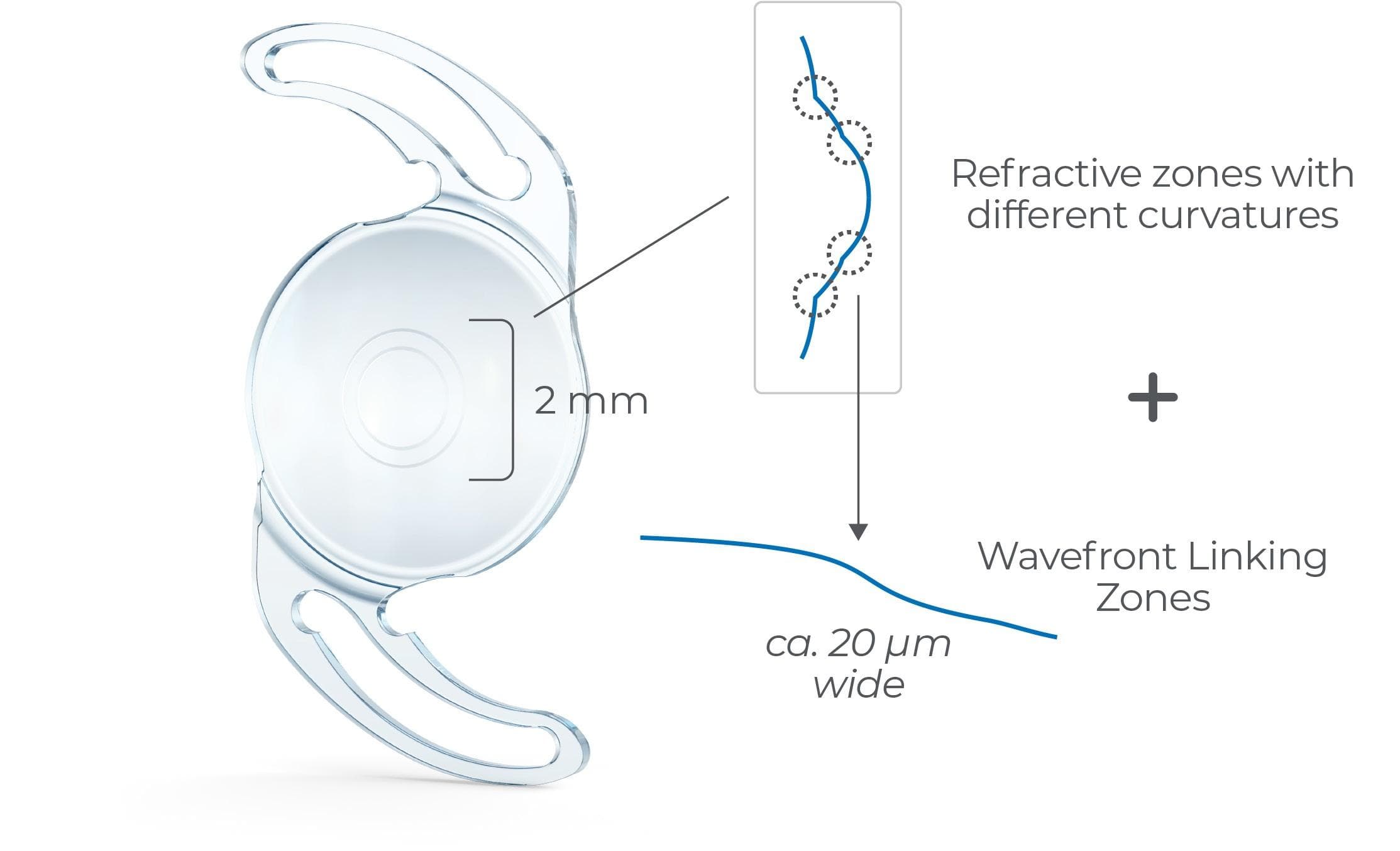 Right on Target: Elon Extended Depth of Focus IOL