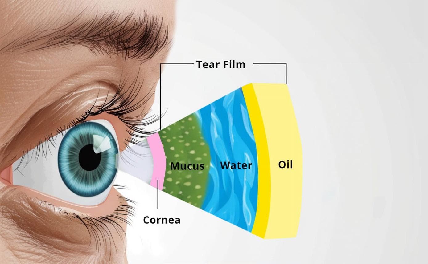 Towards the Light: IPL and Rexon-Eye for Dry Eye Treatment