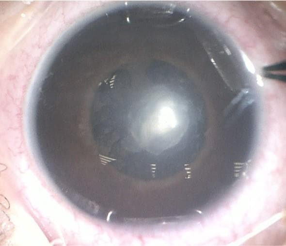 Awareness Building in Community Settings