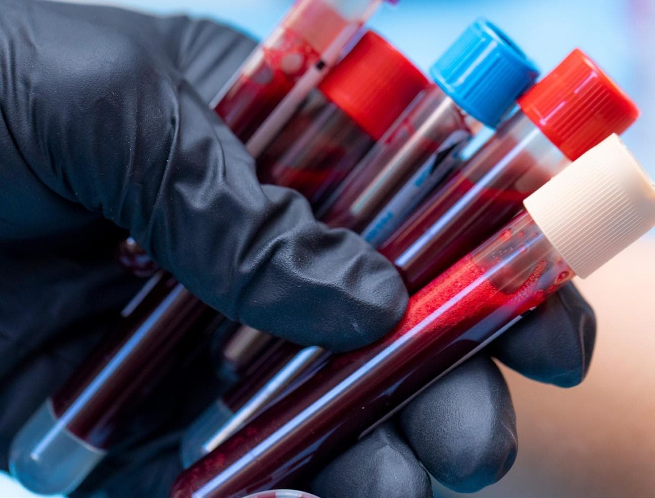 MHRA approves new treatment combo for transplant-ineligible multiple myeloma patients