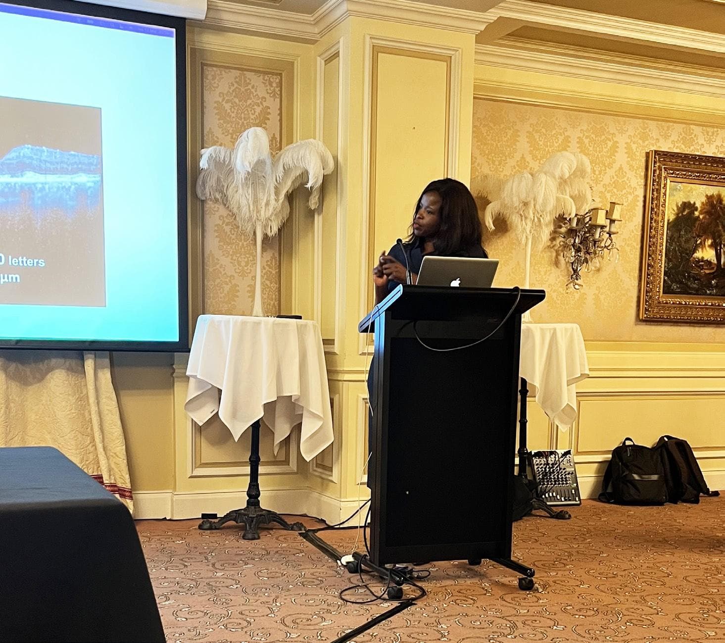 Vabysmo Revolutionising nAMD Treatment in the UK