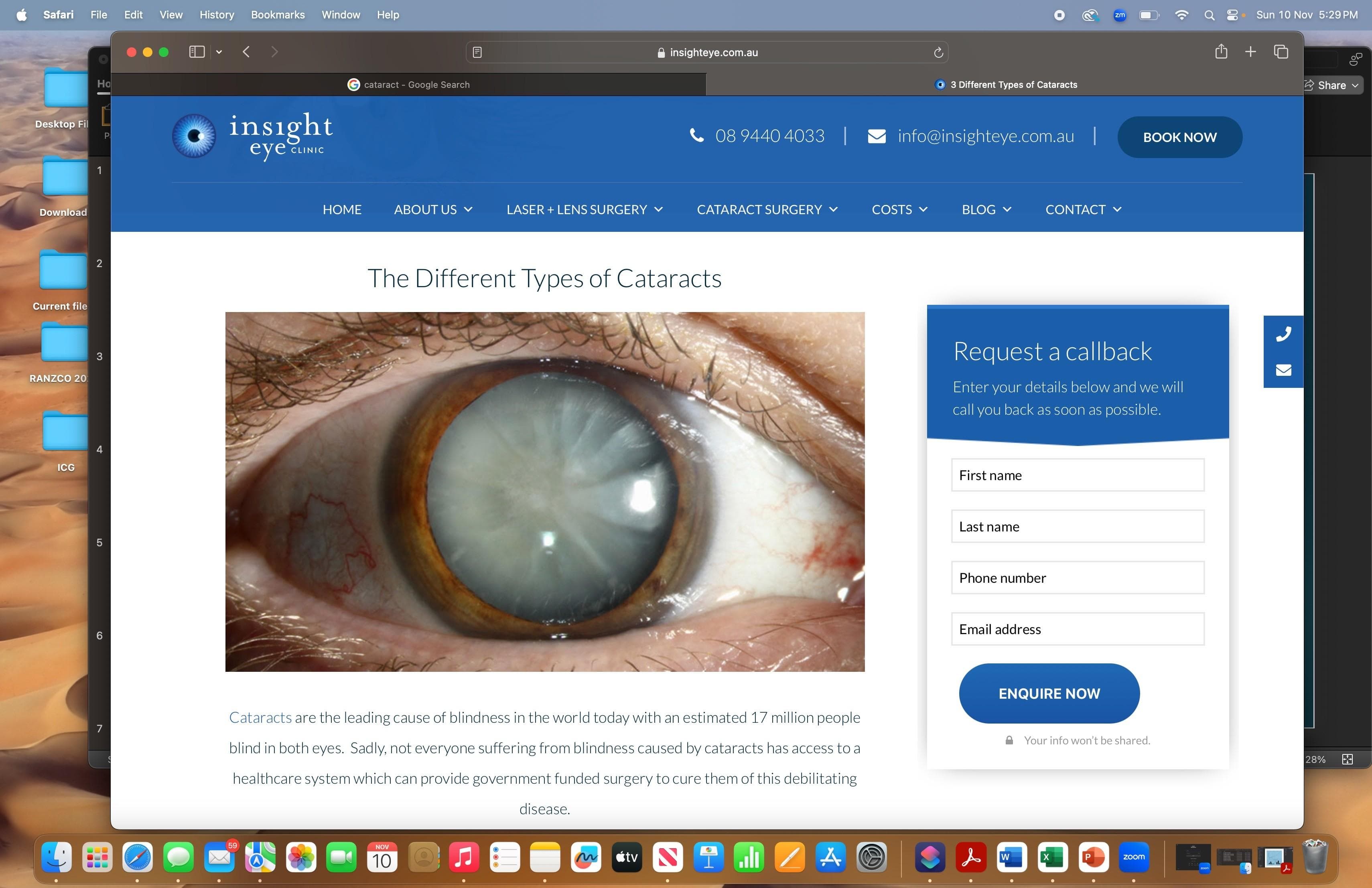 Cataract Surgery & AMDT