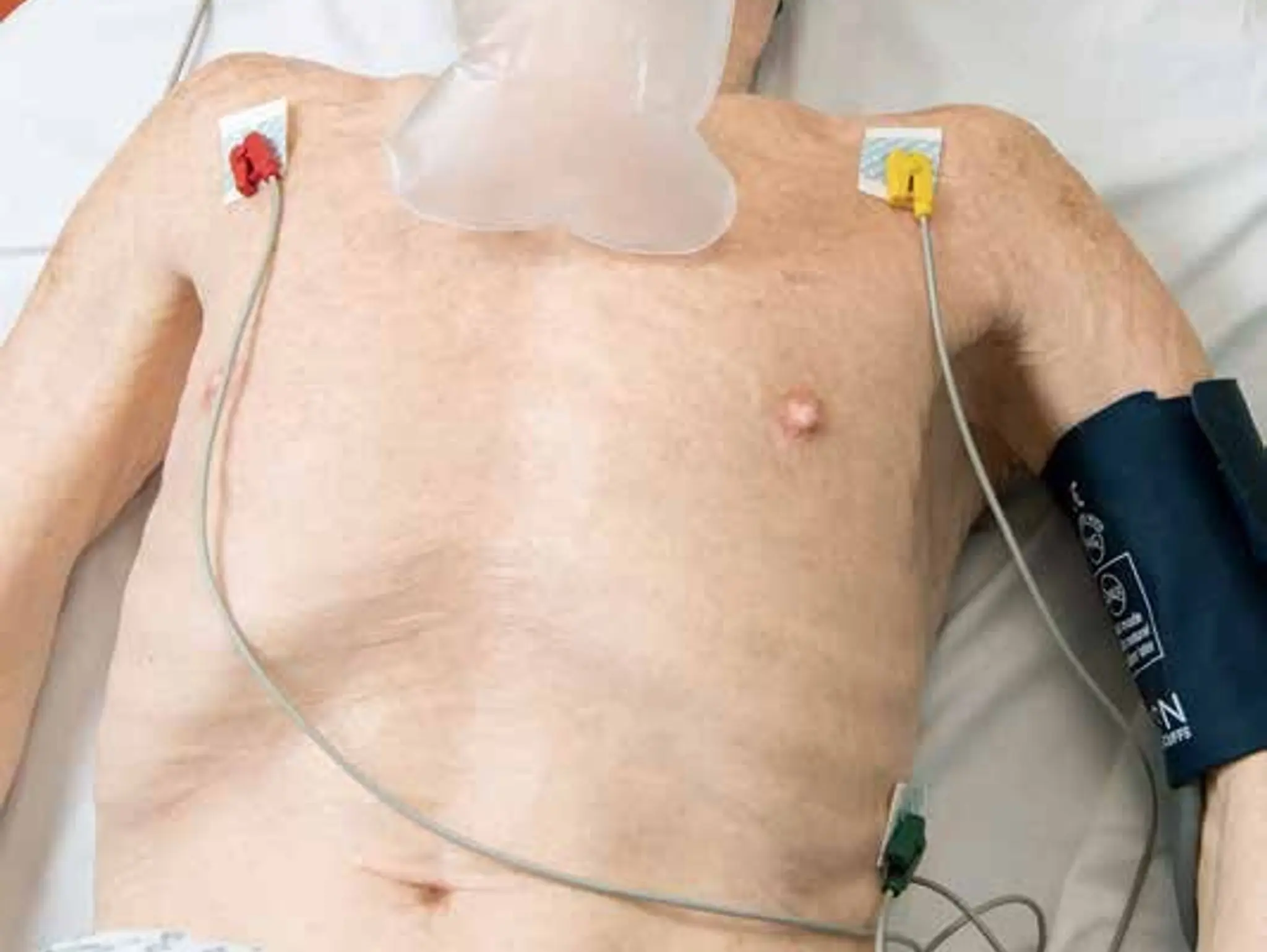 Cardiac arrest rhythms – monitoring and recognition