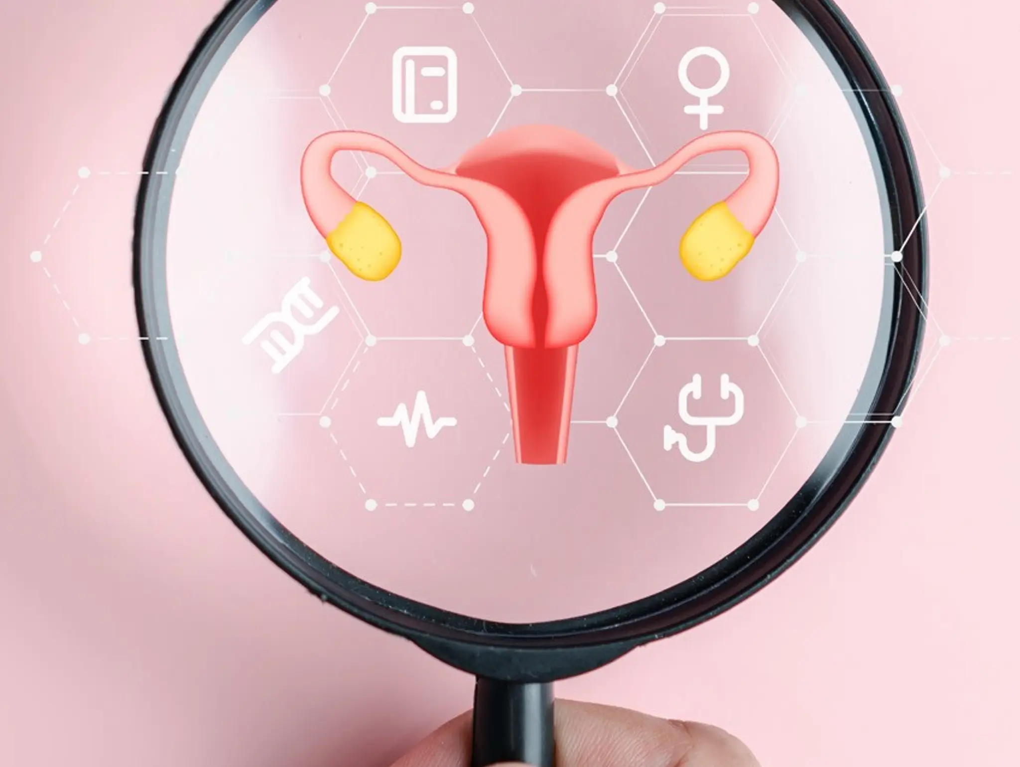 Corcept’s relacorilant improves ovarian cancer survival in phase 3 trial
