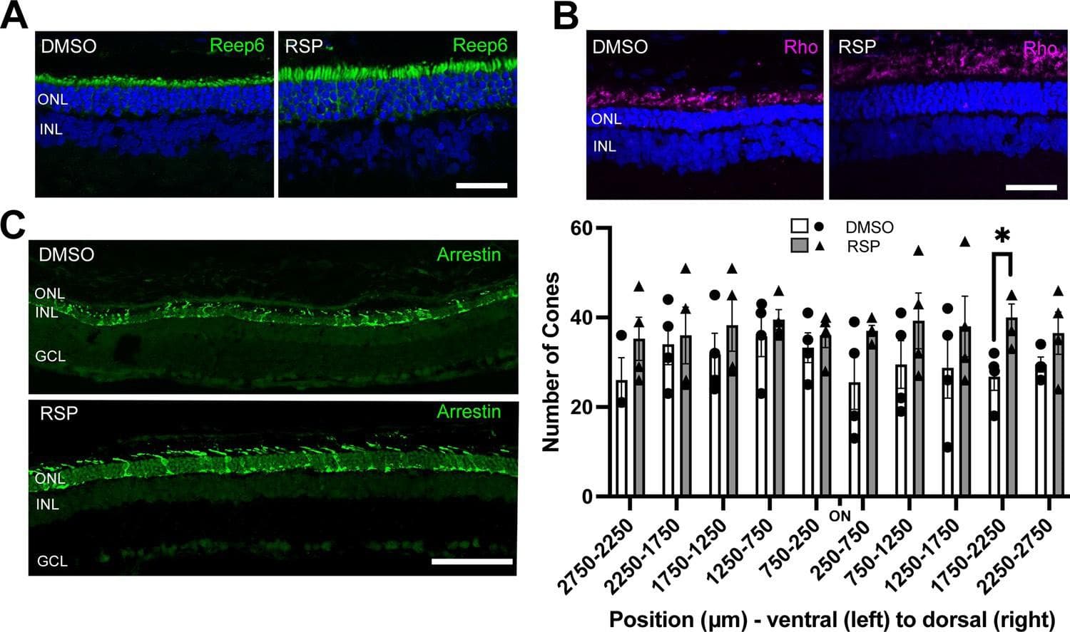 Blood Pressure Drug Could Treat RP