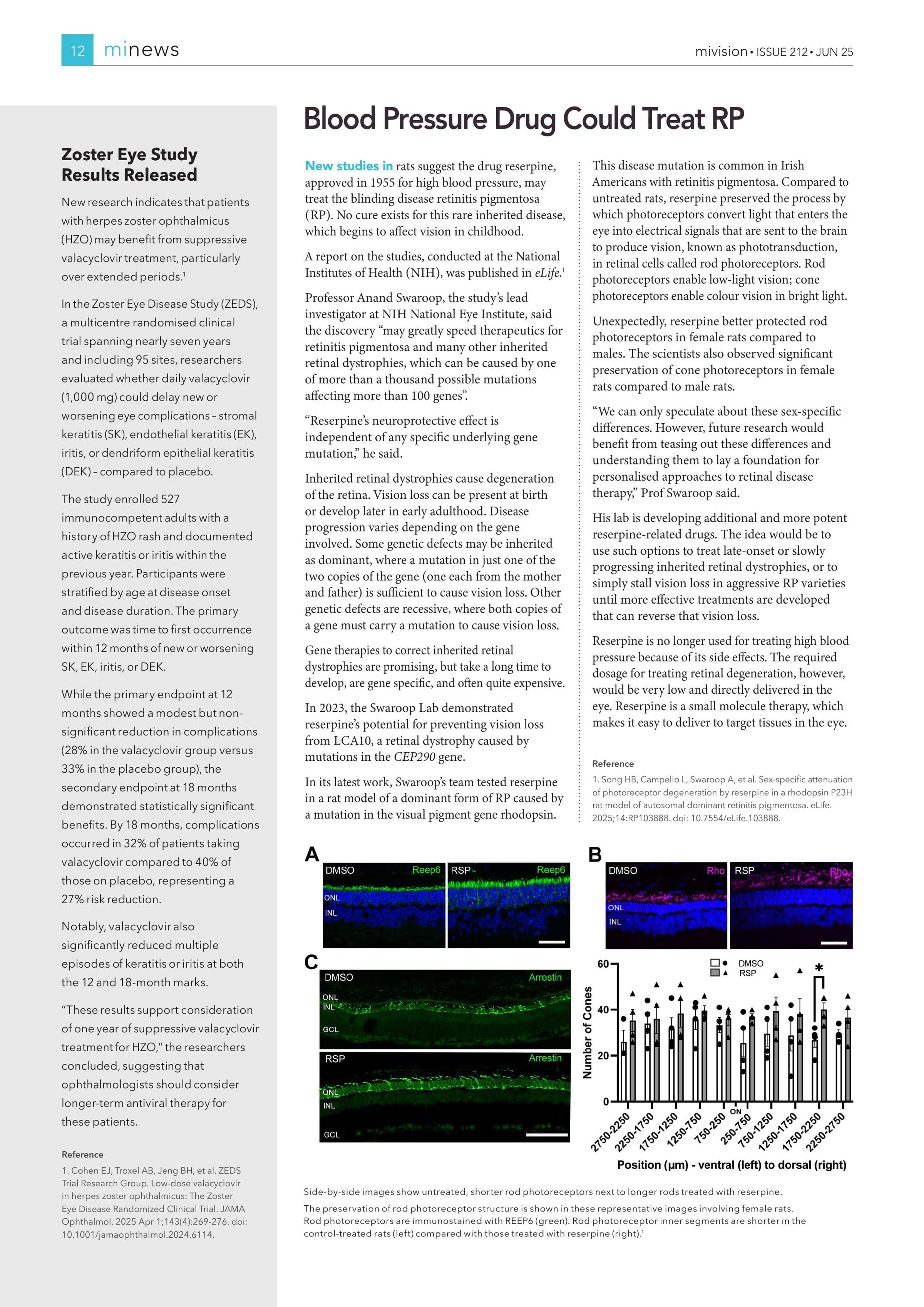 Zoster Eye Study Results Released