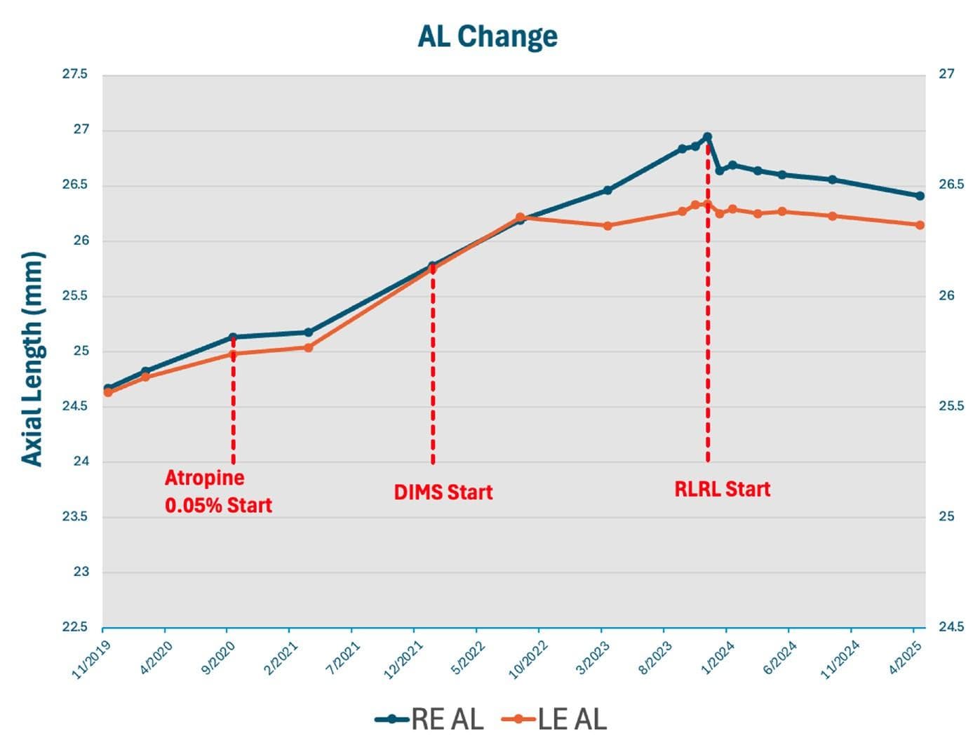 Red Light on the Horizon Ophthalmologists’ Perspectives on RLRL