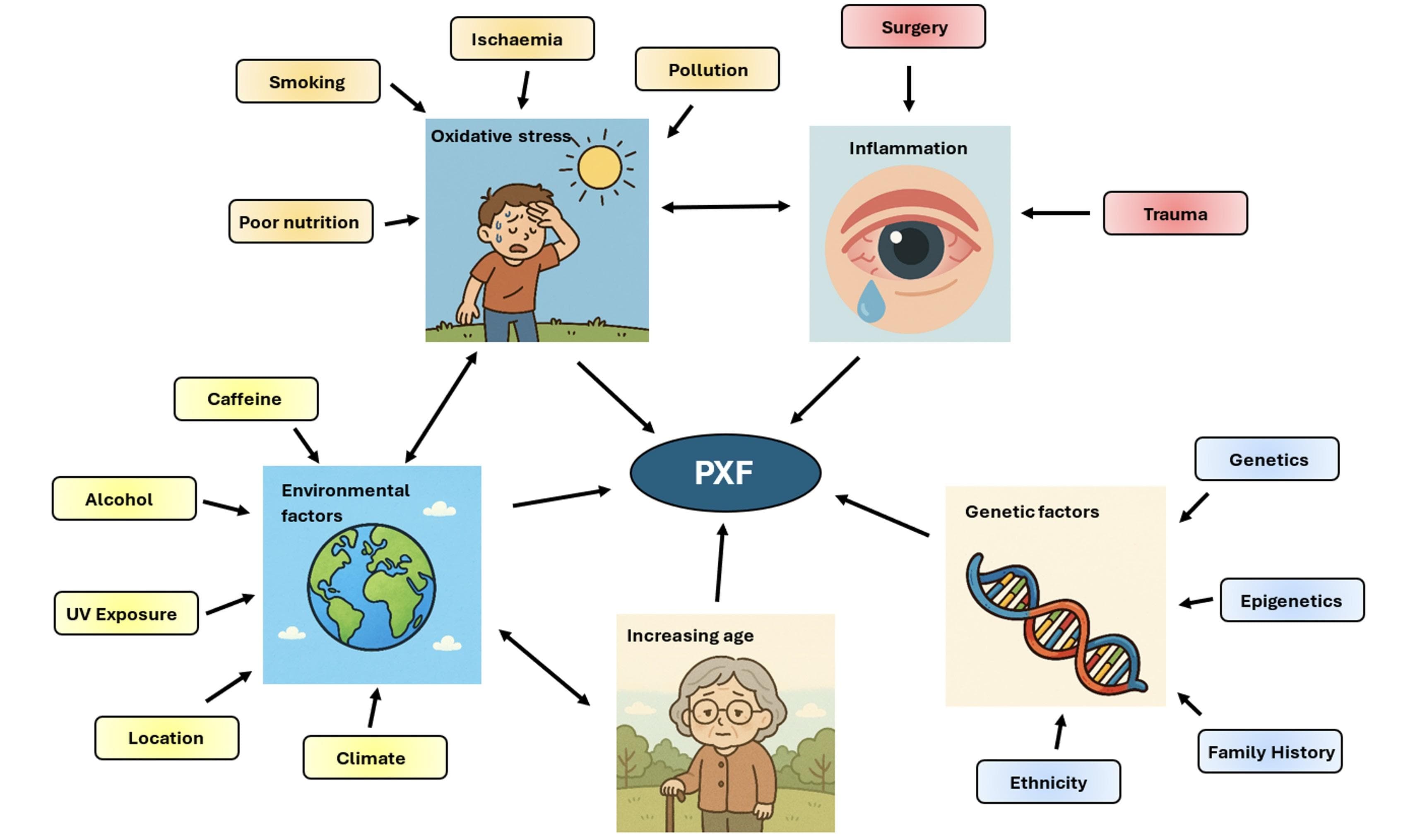 More Than Meets the Eye Pseudoexfoliation Syndrome
