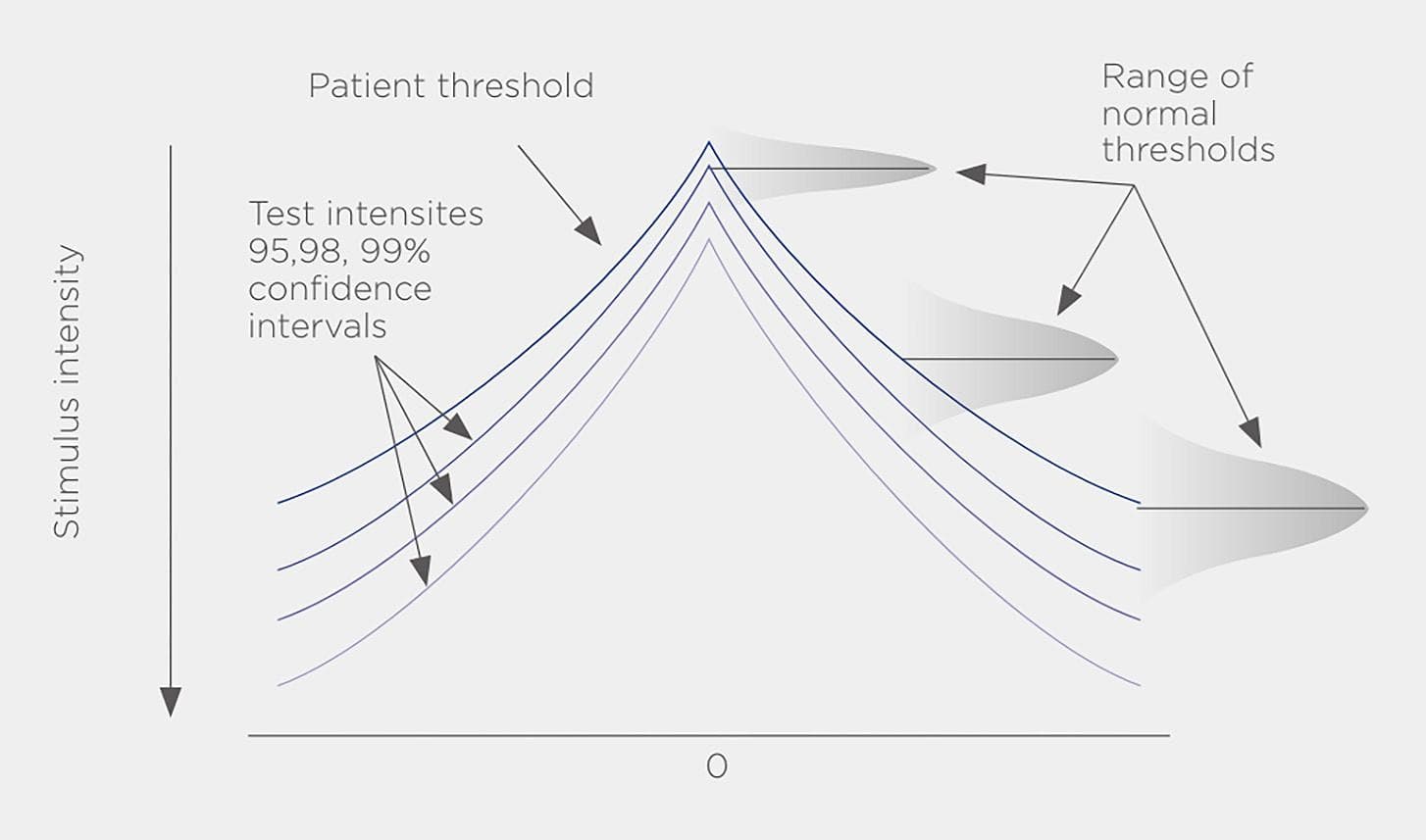 Managing Glaucoma: Quest for Efficient Visual Field Analysis