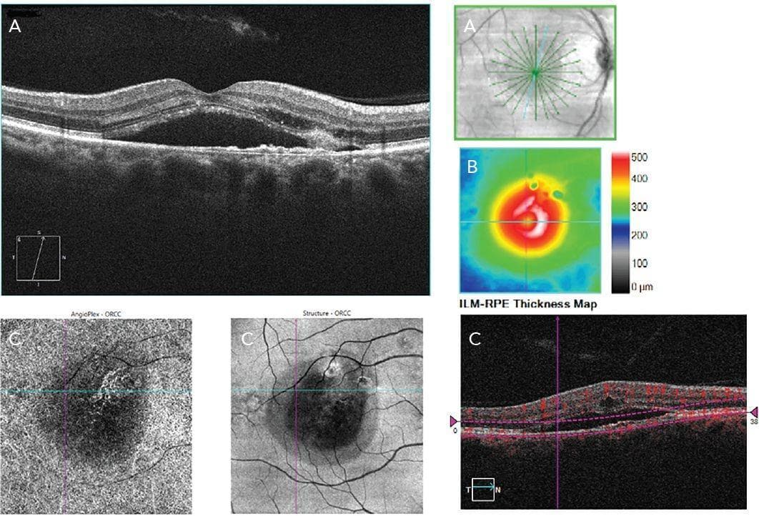 Ocular Imaging on OCT: A Technical Masterclass