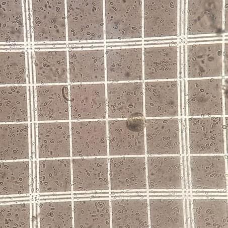 Nosema ceranae CONFIRMED IN WA