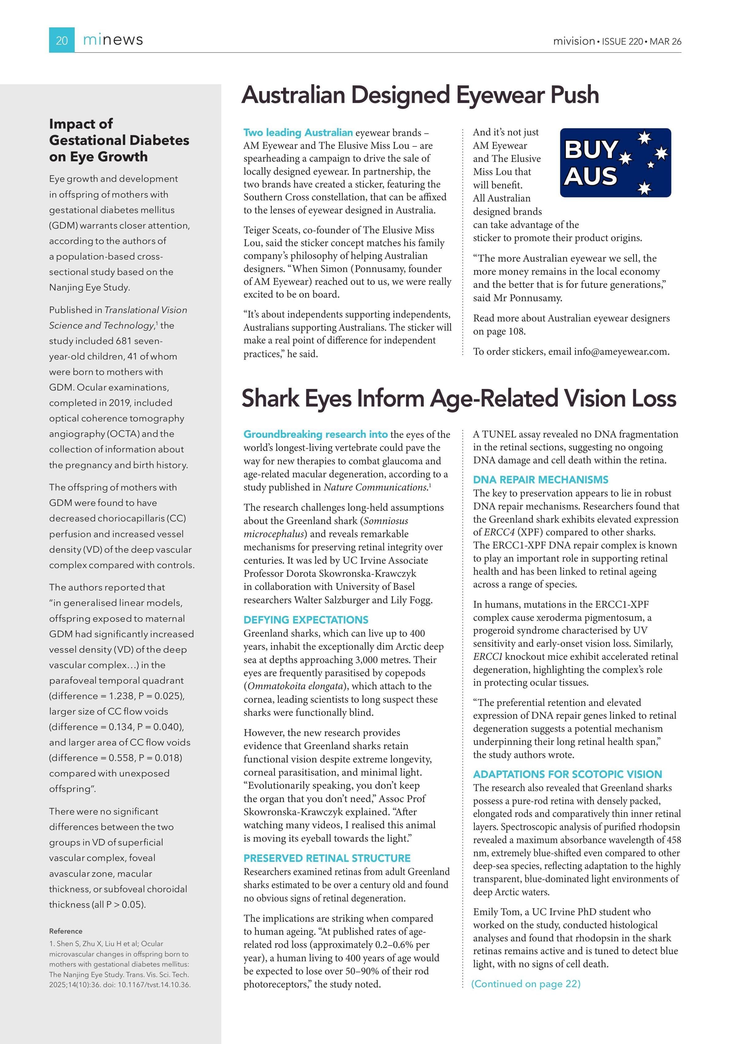 Impact of Gestational Diabetes on Eye Growth