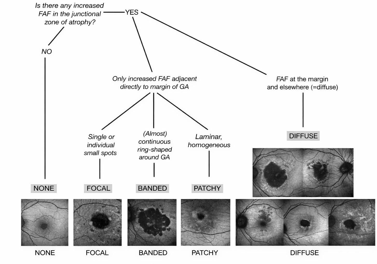 Imaging in Geographic Atrophy