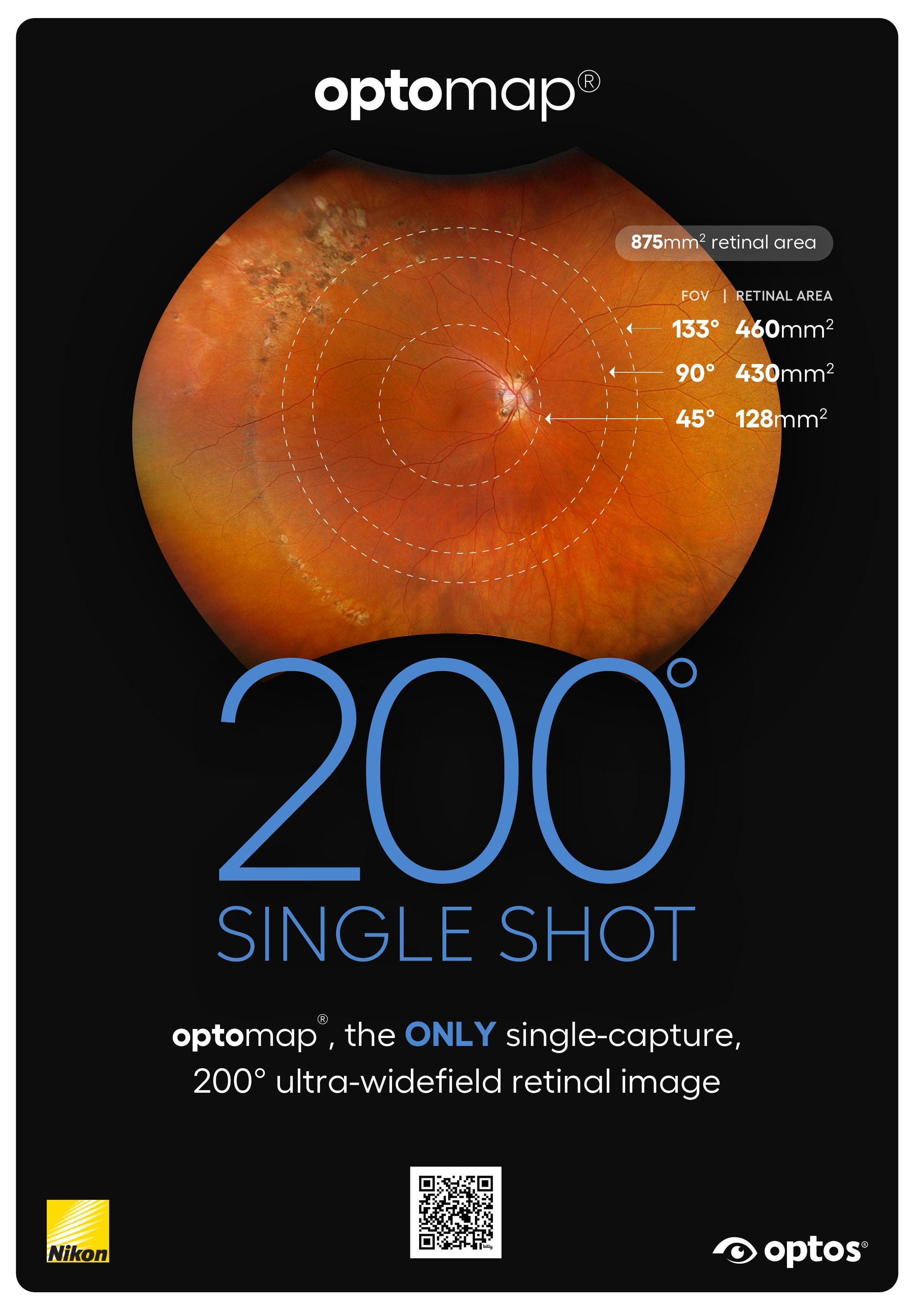 optomap®