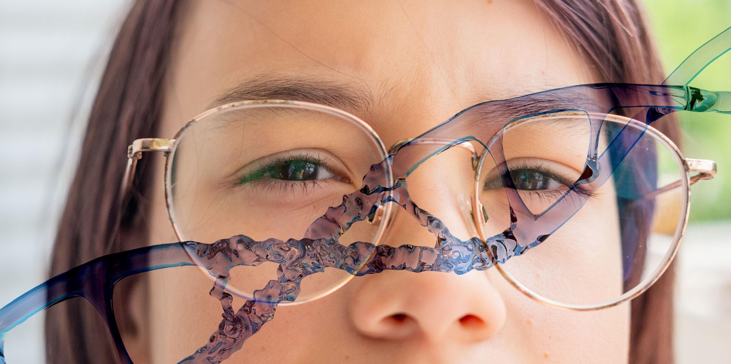 Inherited Eye Conditions