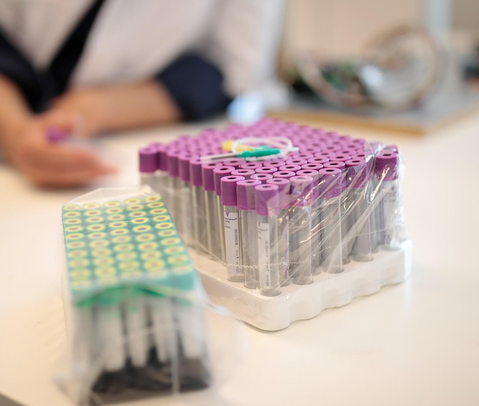 AI, 3D Reconstruction, and Robotics in Clinical Phlebotomy