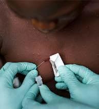 Global monkeypox cases rise to 26,000