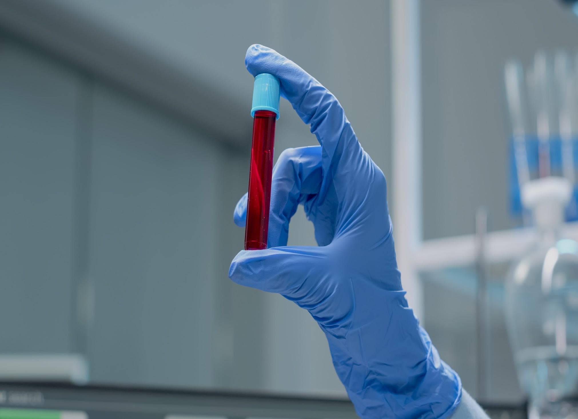 Five Factors Driving Cell and Gene Therapy Developers Towards Gammaretrovirus