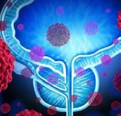 Astrazeneca And MSD Launch Prostate Cancer Awareness Campaign