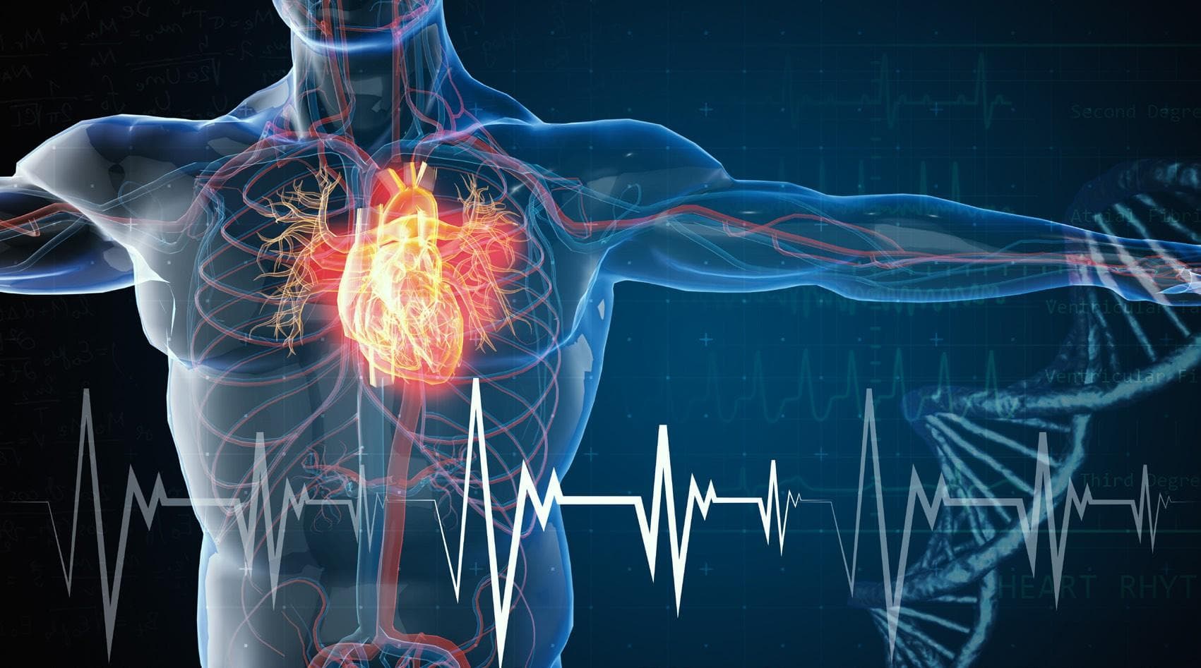 Five Facts About Cardiovascular Disease (CVD)