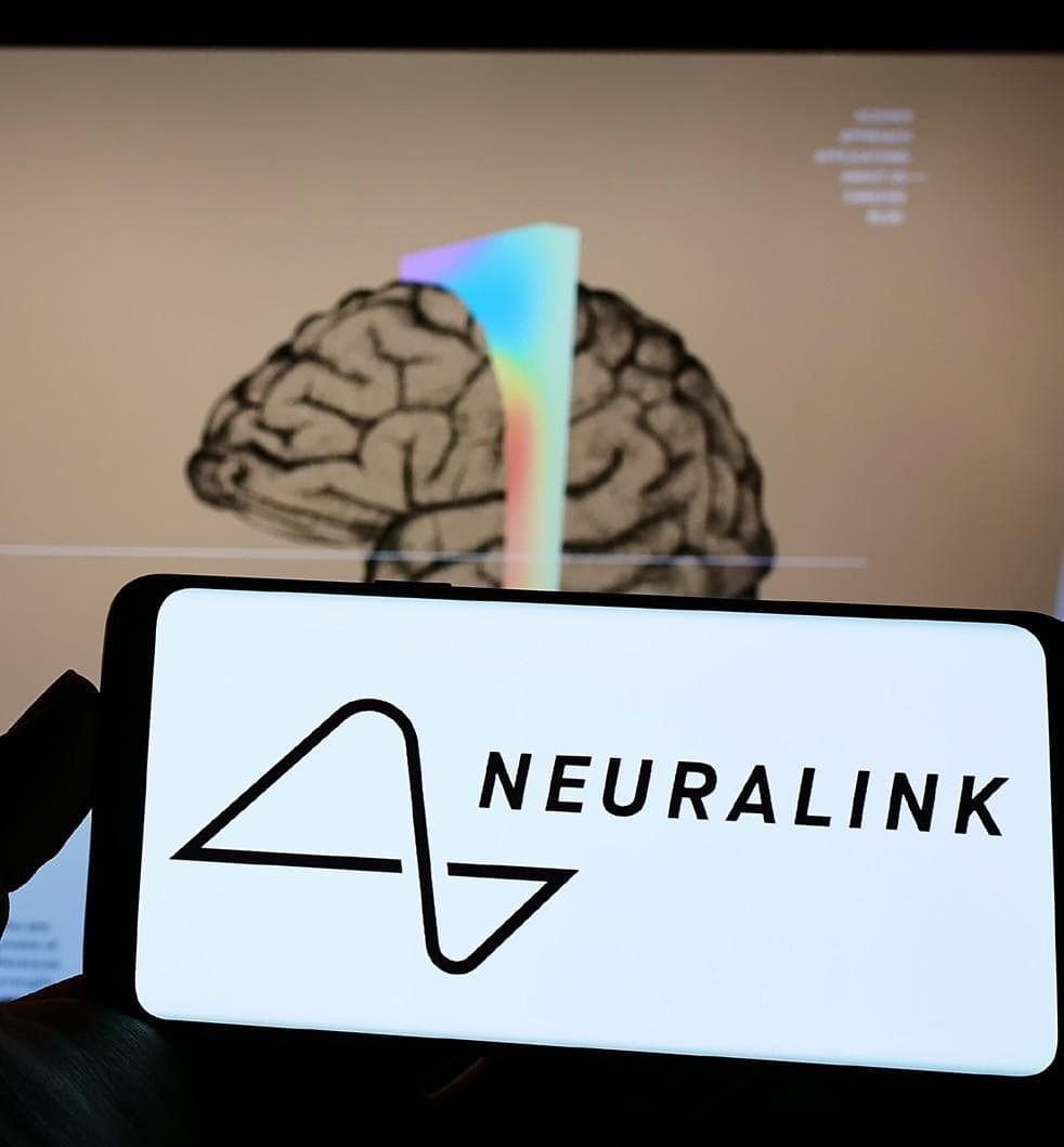 Elon Musk’s Neuralink rejected by FDA for human trials