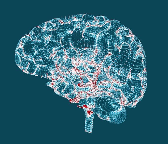 Alzheimer’s drug Leqembi expected to generate $12.9bn in sales by 2028