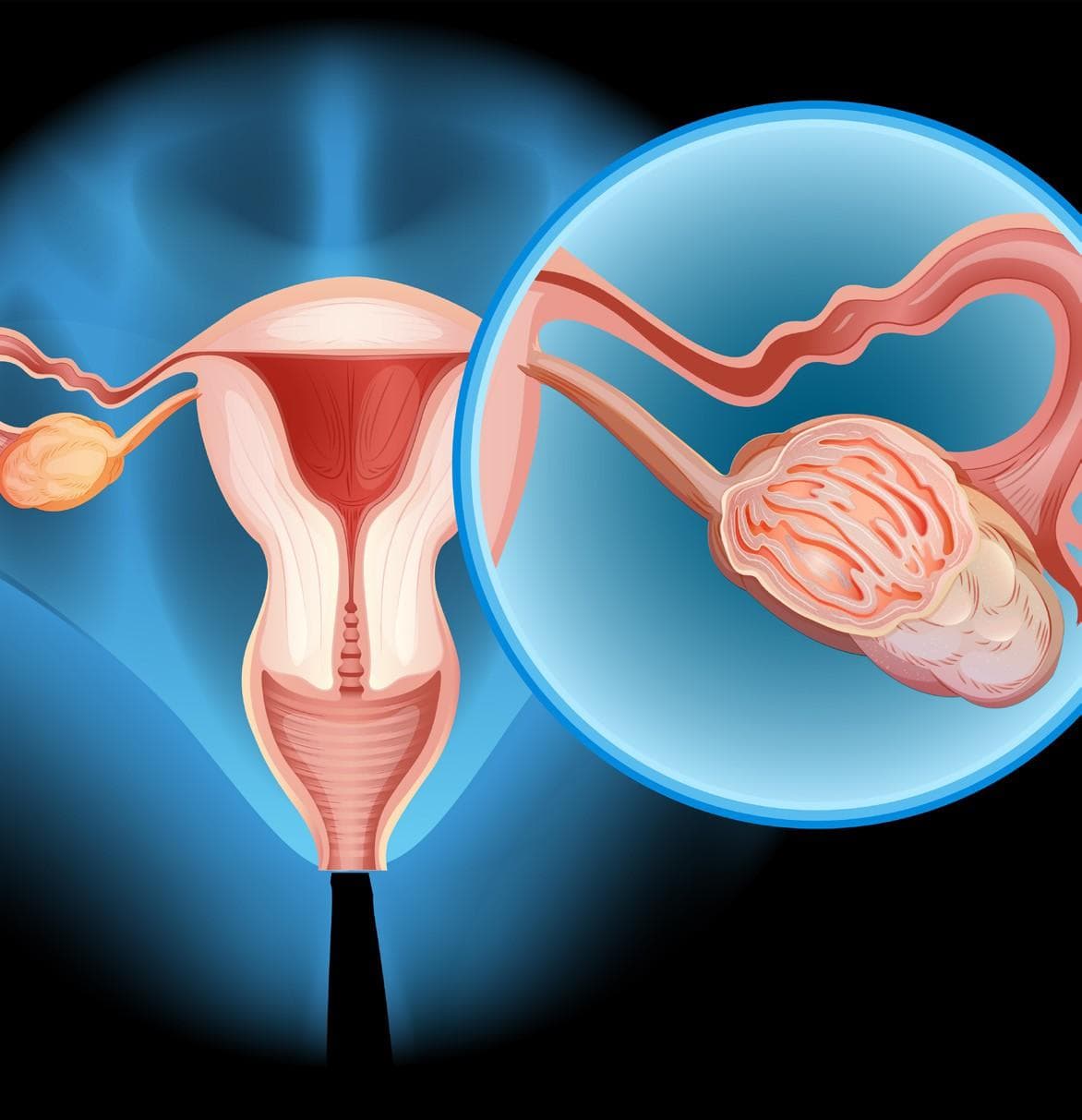 Promising ovarian cancer drug enters phase 3 trial