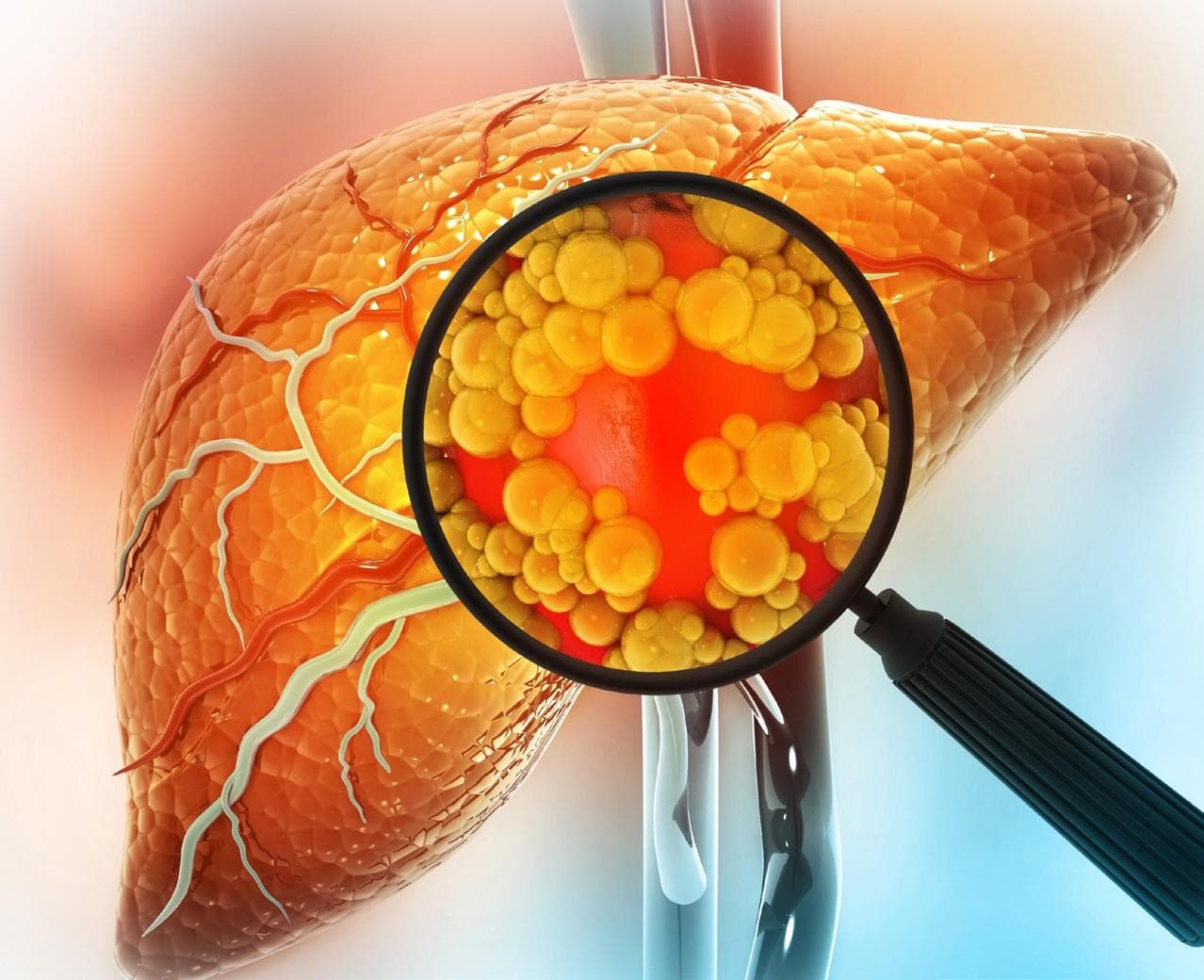 Merck’s relapsing multiple sclerosis trial put on FDA partial clinical hold over liver injuries