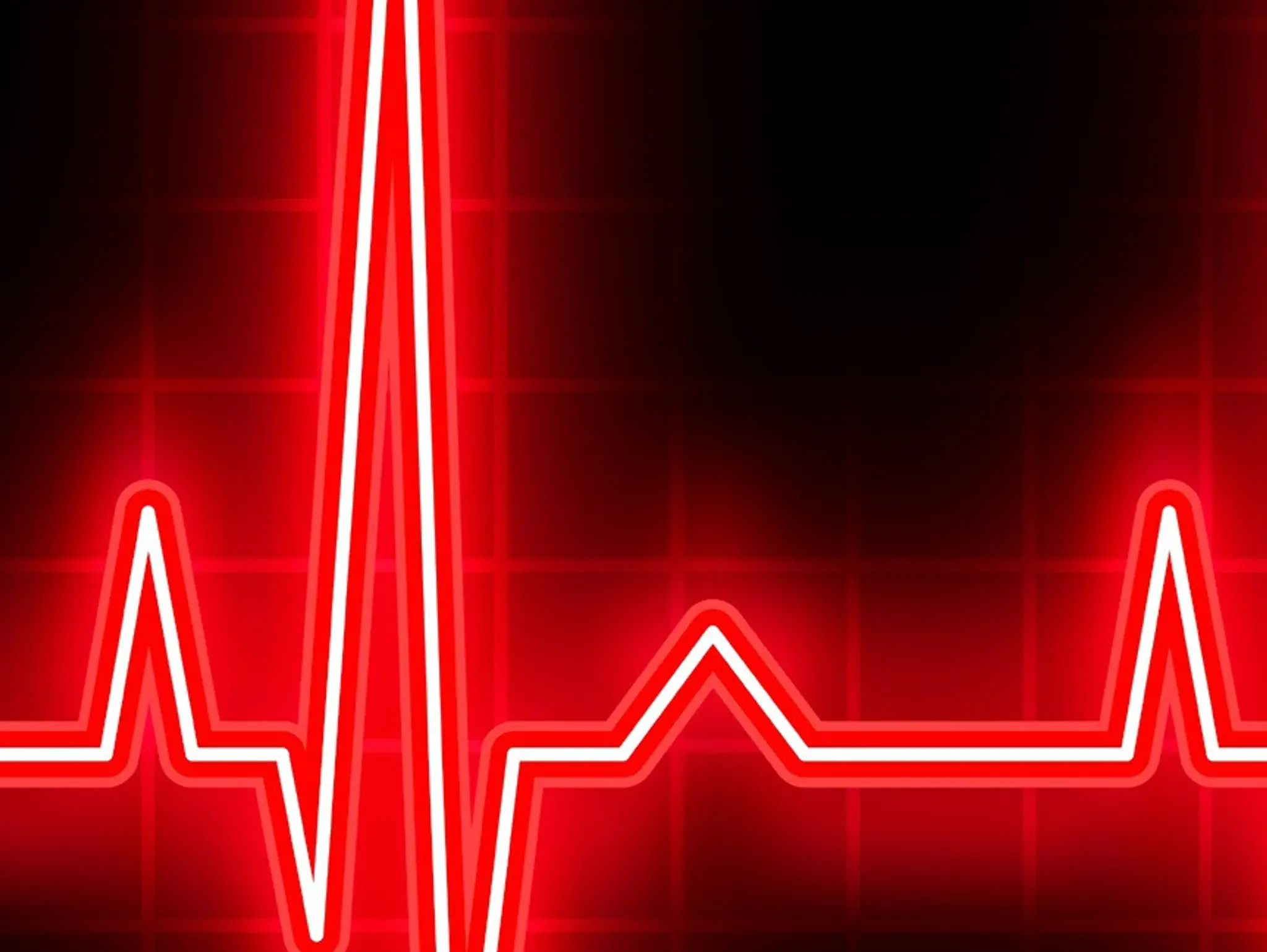 FDA approves Abbott’s Assert-IQ insertable cardiac monitor