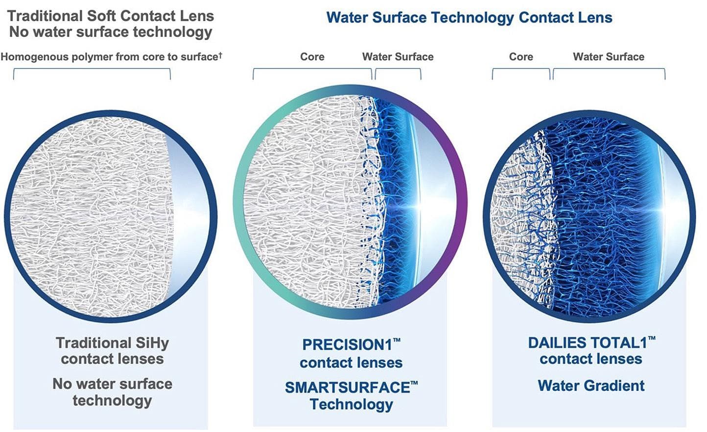 Water Surface Technology Contact Lenses vs. Traditional Soft Contact Lenses