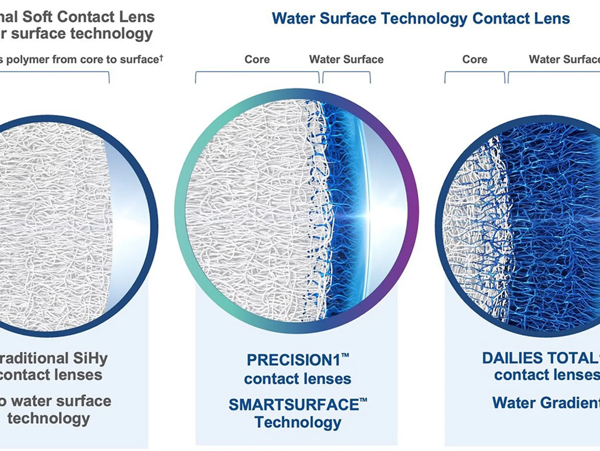 Water Surface Technology Contact Lenses vs. Traditional Soft Contact Lenses