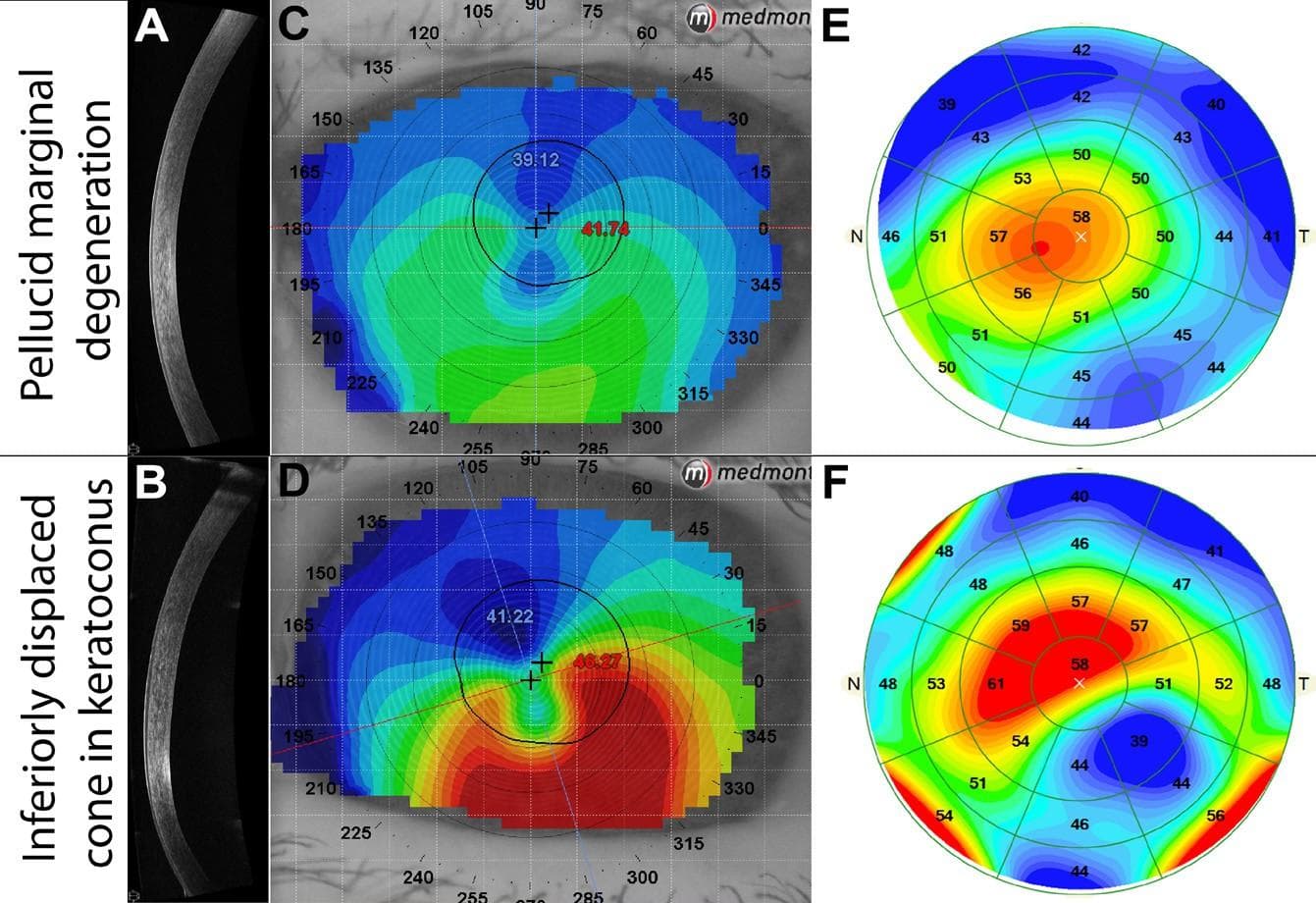 Unconventional Uses of Optical Coherence Tomography