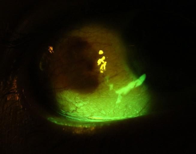 Spring has Sprung: Attack of the Magpies